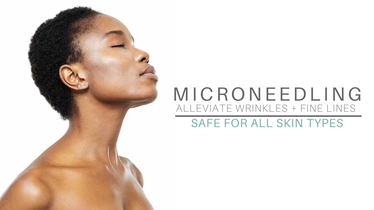 Microneedling Natural Skin Rejuvenation